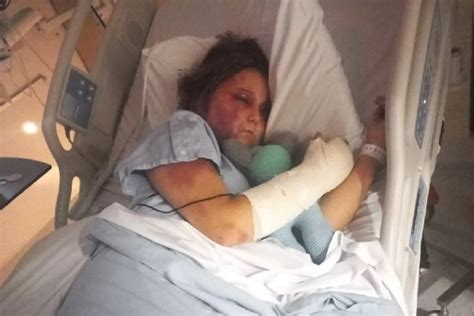 kirra hart getting beat up video|Three teenage girls charged over alleged torture of。